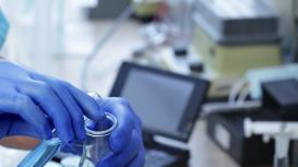 Chemical test in a lab (stock photo)